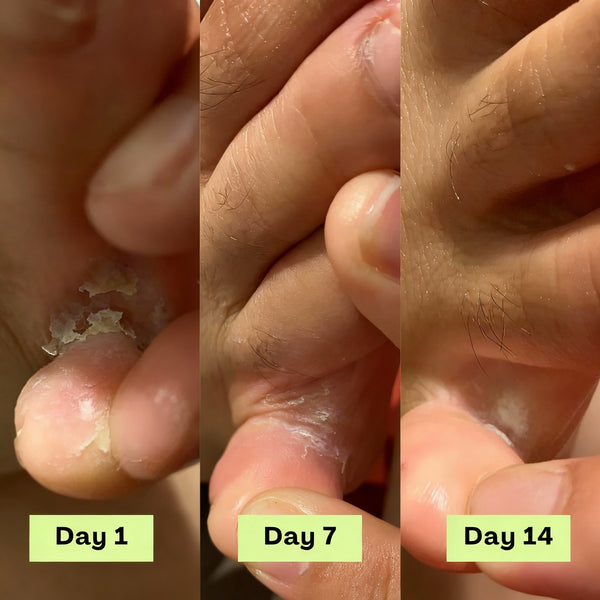 Visible results in just over a week